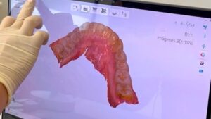La tecnología avanza, también lo hace la calidad del cuidado. Y eso se traduce en algo esencial: diagnósticos precisos, sin esperas y con máxima comodidad para el paciente. Trabajamos con las últimas tecnologías.